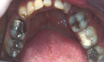 Gentle Dental Cosmetic Dentist Salisbury. Whitening, Veneers